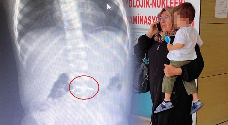 2 yaşındaki Asil yerde bulduğu çiviyi yuttu