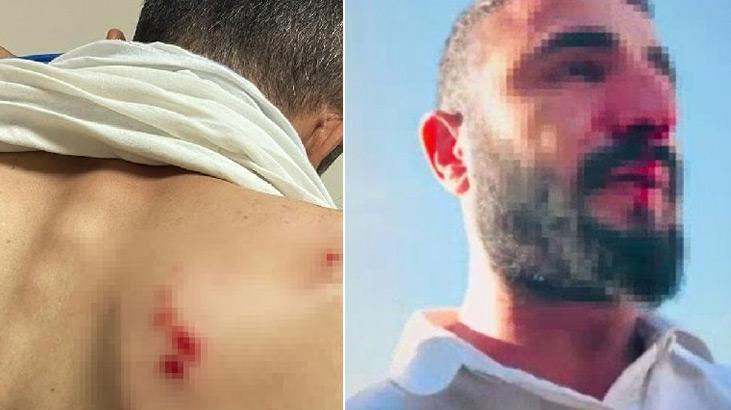 Siirt’te kaçak elektrik kontrolü yapan ekibe saldırı