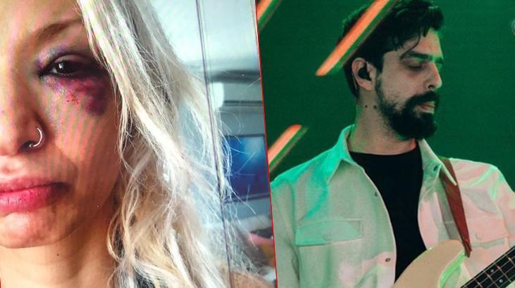 ‘Yüzyüzeyken Konuşuruz’un üyesi Can Tunaboylu’nun eski sevgilisinden darp iddiası!