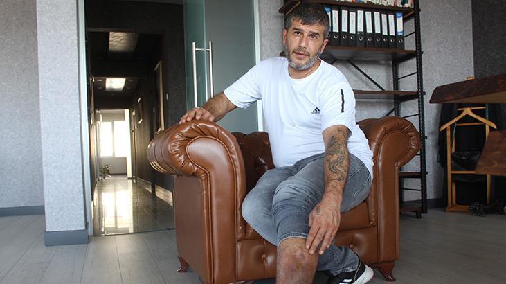 16 yıl önce ameliyat oldu, bacağında kumaş parçası çıktı