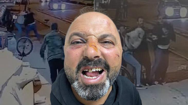 Konya’da baba ve oğula dayak! Sebebi: Ne bakıyorsun!