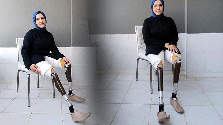 Zeynep’ten yeni protez bacakları için başlattığı yardım kampanyasına destek çağrısı