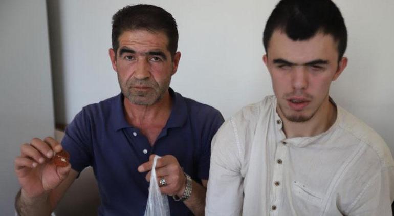 Görme engelli genç ölümden döndü! Sucuğun içinden çıkan şoke etti