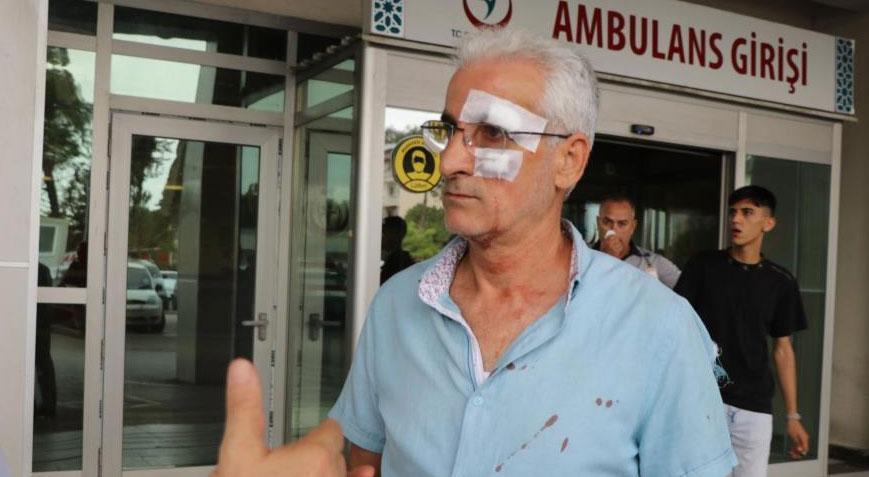 Taksici öğretmene dehşeti yaşattı! Yüzüne 7 dikiş atıldı