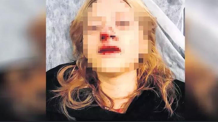 Kaldırım taşıyla dişlerini kırmışlardı: Görmedim dedi