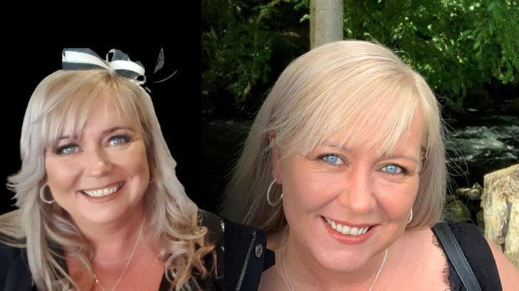 Mide küçültme ameliyatı sonrası feci ölüm! Aile peşini bırakmadı