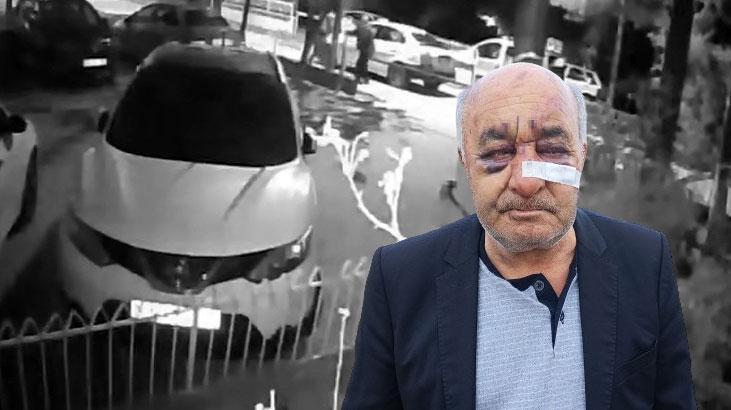 Öldüresiye dövülen taksici dehşeti anlattı: Gözümün merceği kaydı