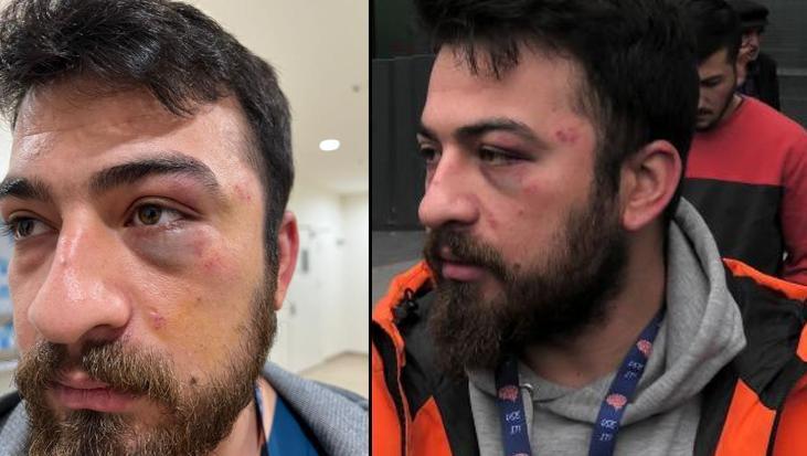 Yer: Şişli! Hemşireye ‘eldiven kirli’ dayağı