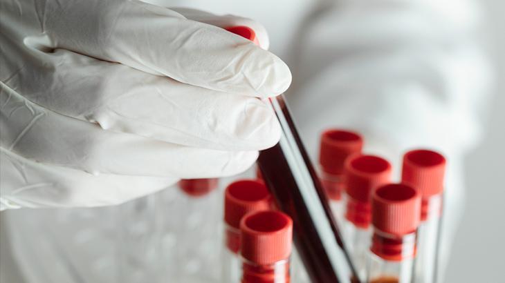 Bilim insanları, kan testinin organların hangi hızda yaşlandığını gösterebileceğini söylüyor
