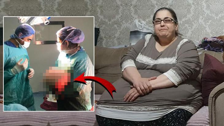 Hareket etmekte güçlük çekiyordu! Vücudundan 25 kiloluk yağ dokusu çıkarıldı