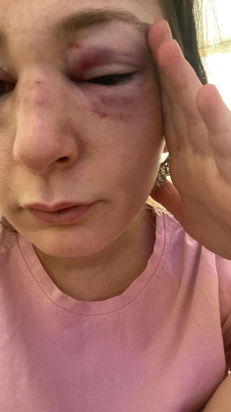 Yüzünü tanınmaz hale getirdi: Her kafa darbesine 1 yıl