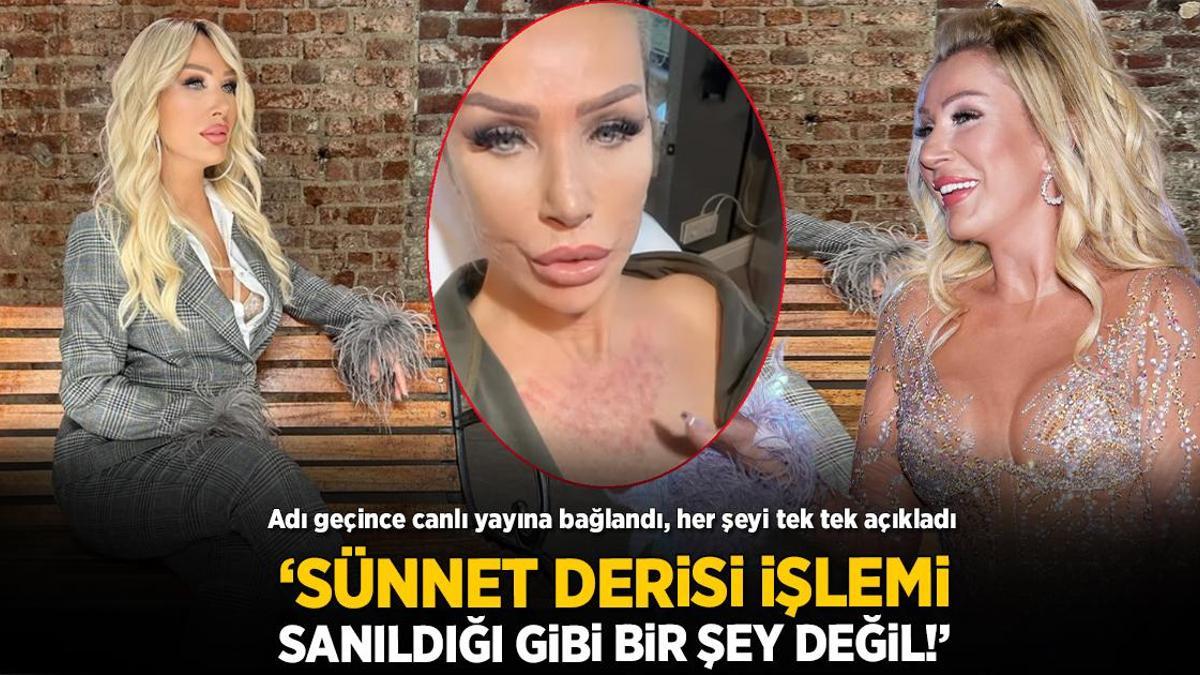Seda Sayan’dan ‘sünnet derisi’ açıklaması! Canlı yayında tek tek anlattı