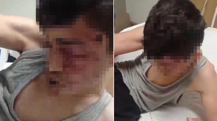 Gaziantep’te 15 yaşındaki çocuğu öldüresiye dayak!