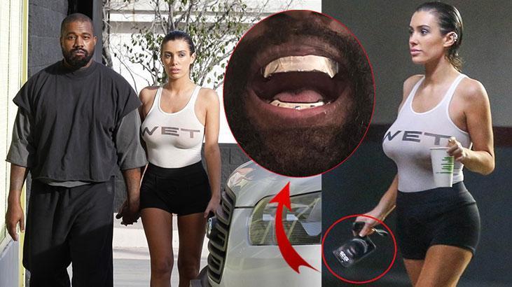 Ünlü rapçinin binlerce dolar harcadığı dişleri eşinin telefonunun arka planında!