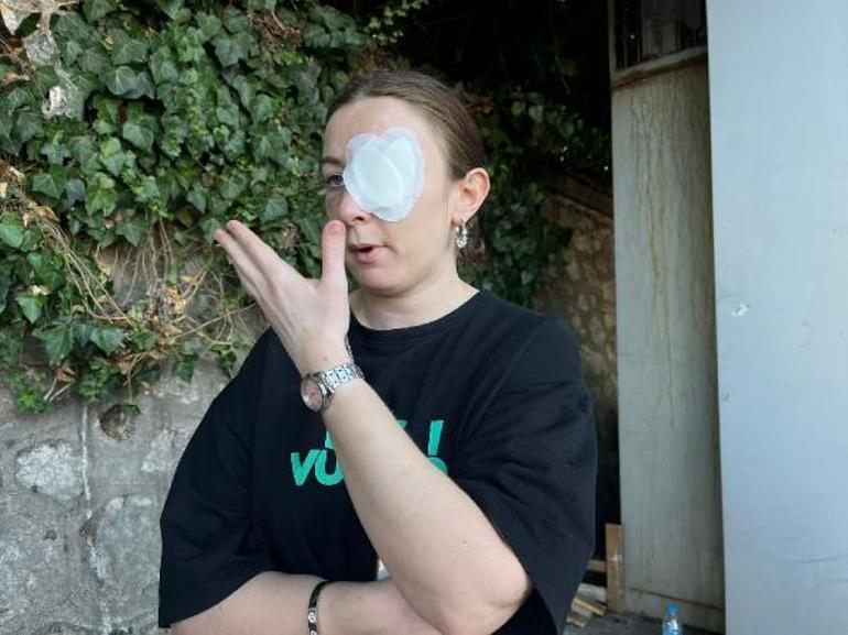 Hayatını kabusa çevirdi, ne yaptıysa kurtulamadı:Vücudumda defalarca sigara söndürdü