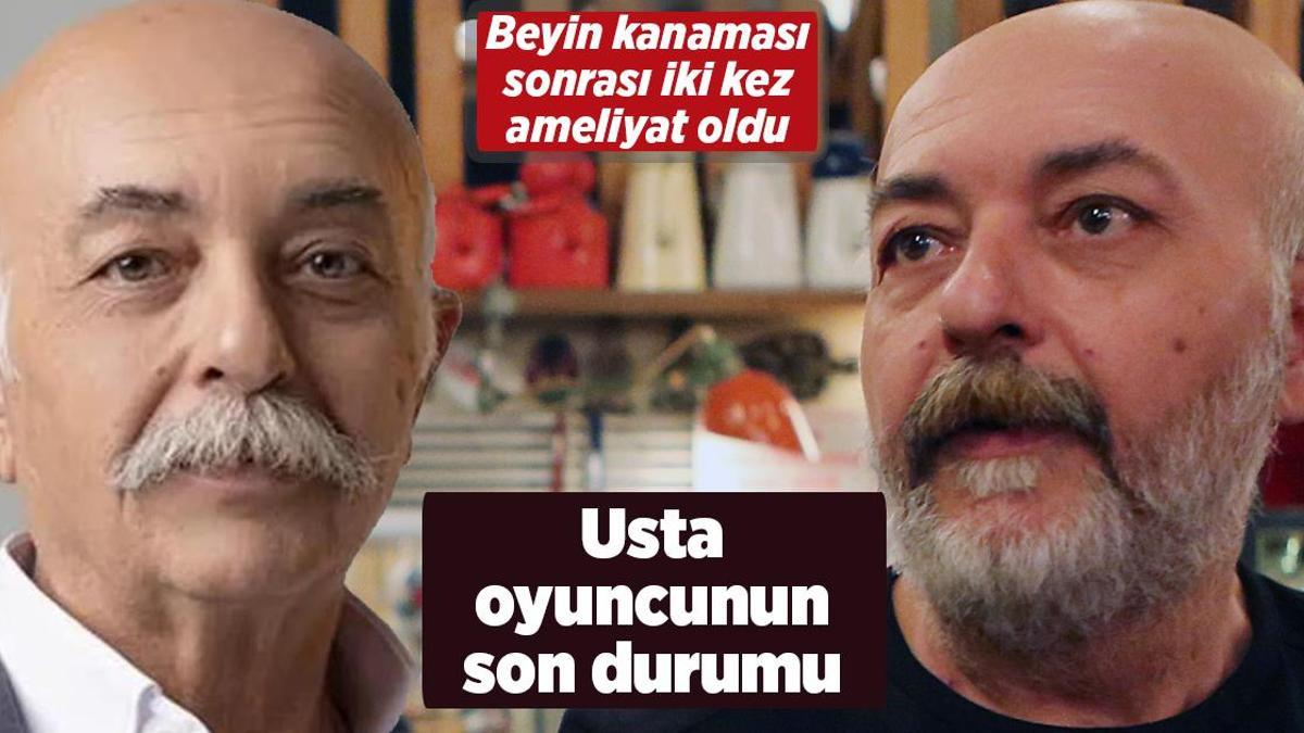 Beyin kanaması geçiren Settar Tanrıöğen’in son durumu!