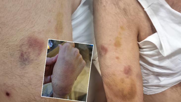 Zihinsel engelli öğrenciye öğretmen şiddeti: İşkence görmüş, dayak değil