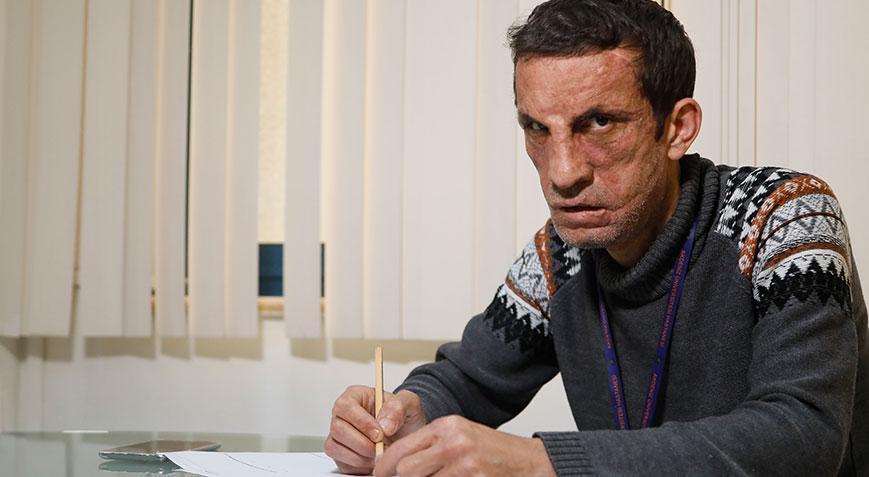 Türkiye’nin ilk yüz nakillisi Uğur Acar, üniversiteye hazırlanıyor