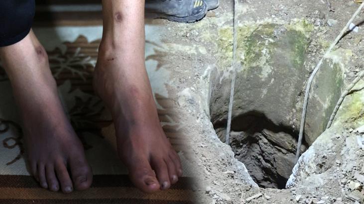 Yolda yürürken kendini kuyuda buldu: Öleceğimi hissettim