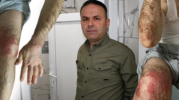 Yaş betona dokununca hayatı karardı: Hastanede tedavi uygulayamadılar