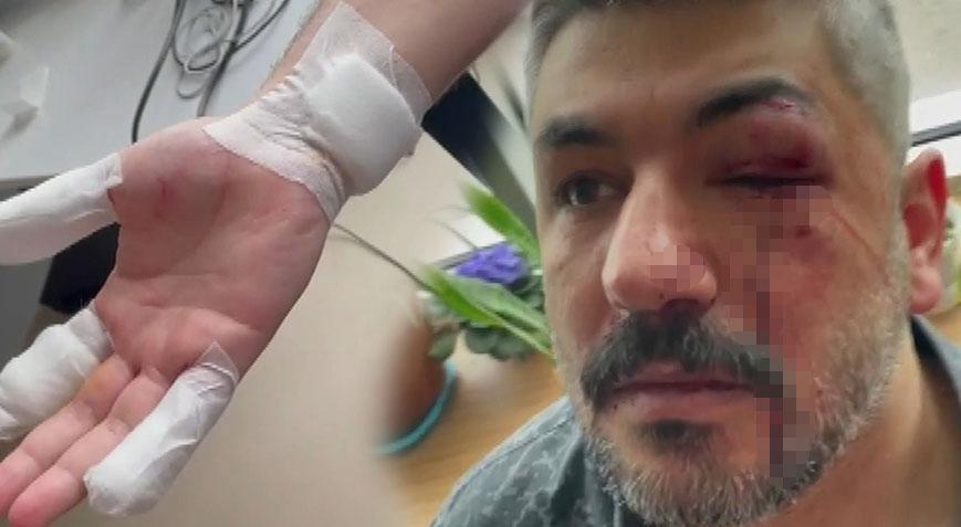 Veliyi hastanelik eden kavga! ‘Sizin veremediğiniz eğitimi, ben döverek veriyorum’