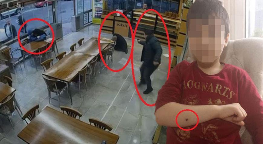 10 yaşındaki çocuk fırında dehşeti yaşadı! Kolumda çizik gibi bir acı hissettim