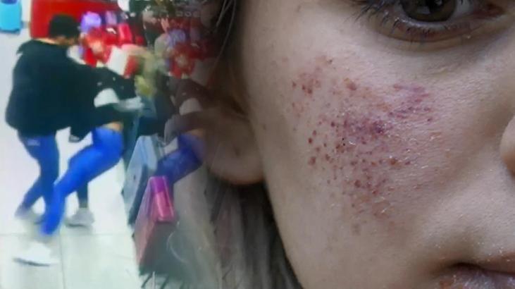 Nişanlıdan öldüresiye dayak: Bir çanta kadar değerim yokmuş