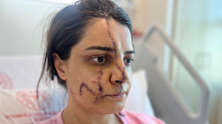 Yüzüne 40 dikiş atıldı, dehşeti anlattı: Takıntı ve saplantılı halde taciz edildi