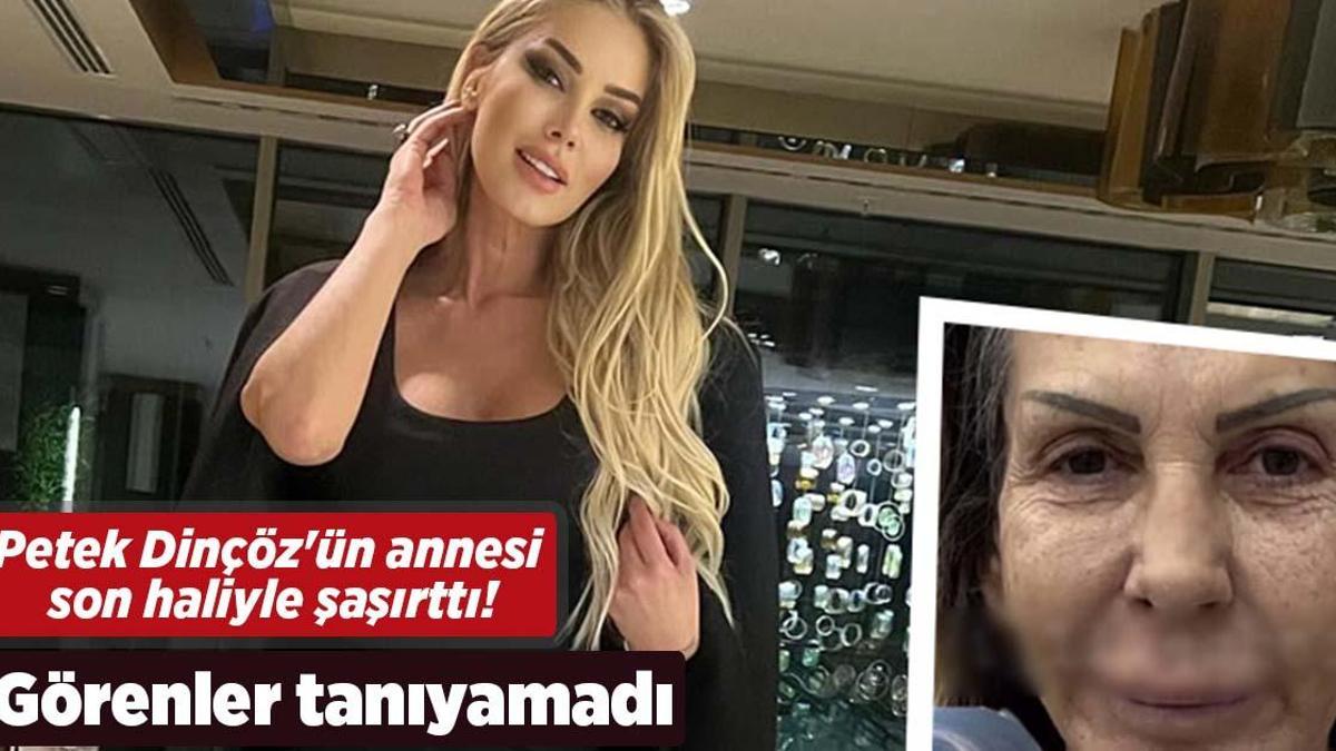 Petek Dinçöz’ün annesi son haliyle şaşırttı! Esra Süay Toğuş’u görenler tanıyamadı