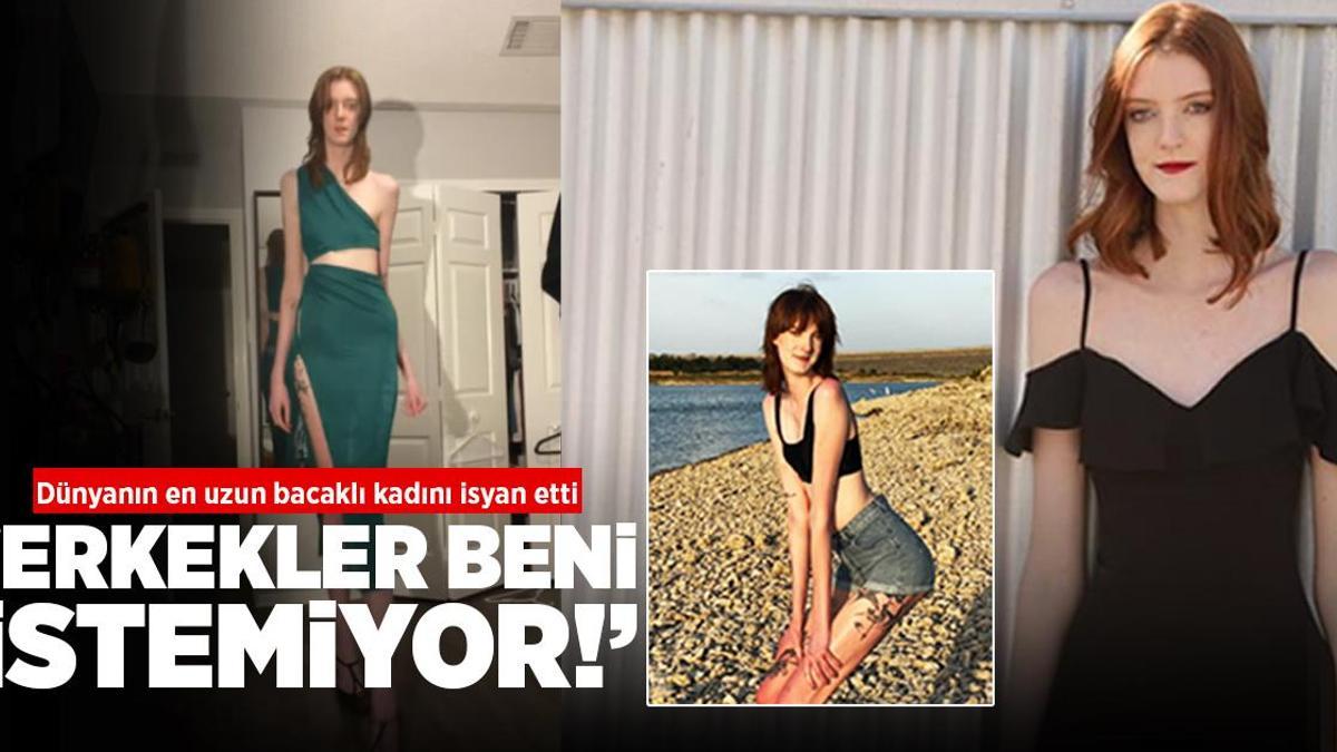 Dünyanın en uzun bacaklı kadını! Sayısız sorunla baş ediyor: Erkekler beni istemiyor