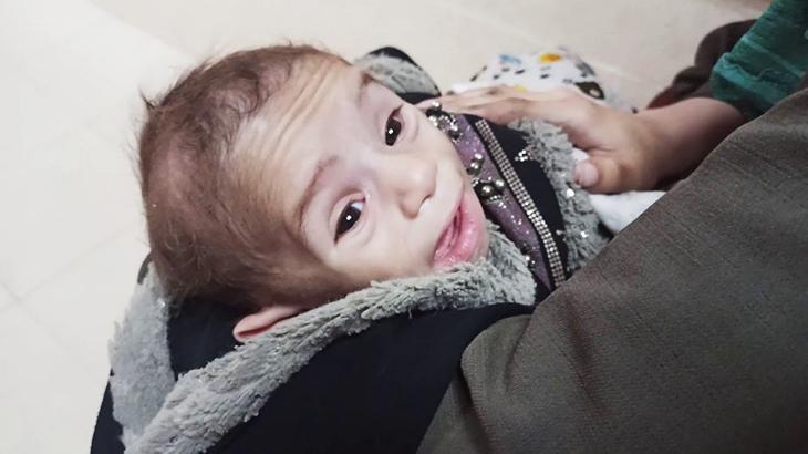 Gıda krizi: Gazze’de açlık ve susuzluktan ölen çocuk sayısı en az 31