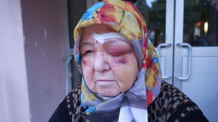 Köpeklerin kovaladığı kadın yere düştü, kanlar içinde kaldı