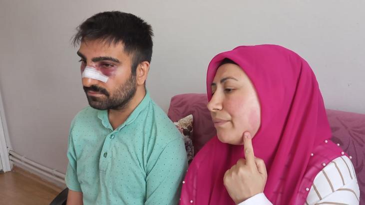 İki komşu aile birbirine girdi! Burnunu kırdı, sıcak su döktü: Gözümü ambulansta açtım