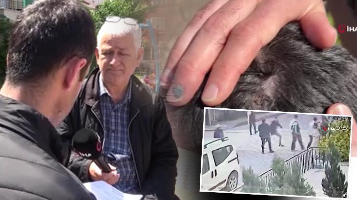 Bekçi ve boksör arasına pitbull kavgası: Sopayı aldım ikisinin kafasına geçirdim