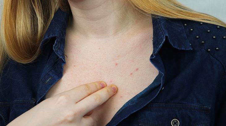 Bu yöntem ölüme götürüyor: Kimi sigara basıyor kimi benzin döküyor