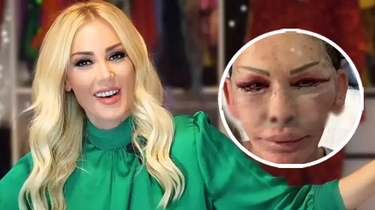 Petek Dinçöz’ün annesi estetik olmuştu! Esra Süay Toğuş’un son hali şaşırttı