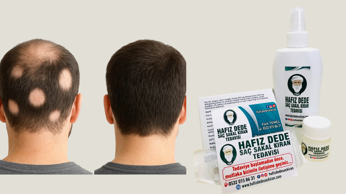 Hafız Dede Saç Kıran Tedavisi: Saç ve Sakal Sağlığına Bütüncül Doğal Yaklaşım