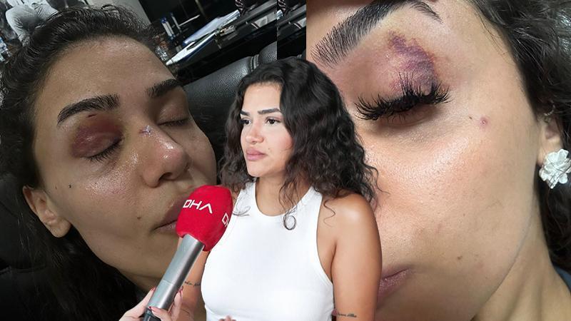 Bahçeşehir’de uzaklaştırma kararına rağmen darbedilen Ebru: “Ölmeden önce sesimi duyun”